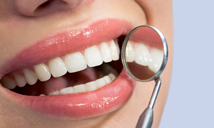 Dental Insurance